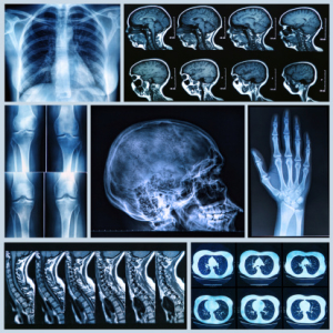 X-Rays